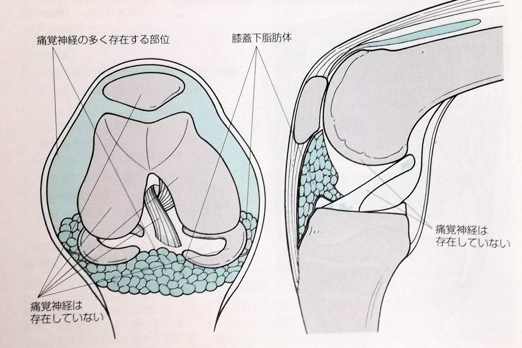 膝痛の原因は軟骨ではない - やすらぎ整体